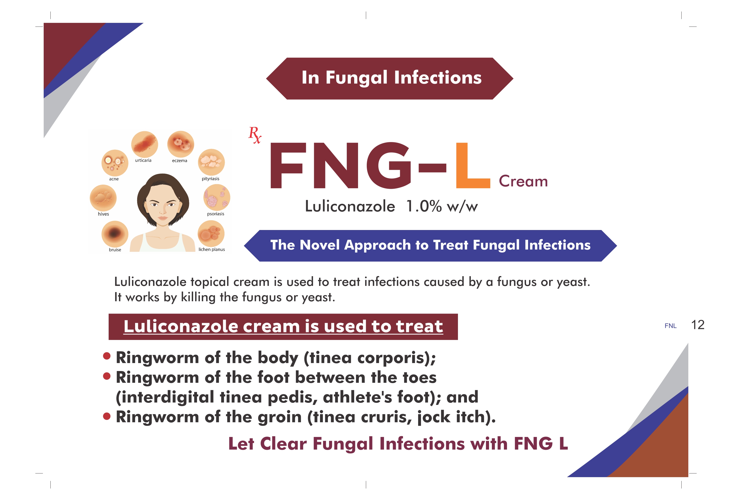 FNG-L